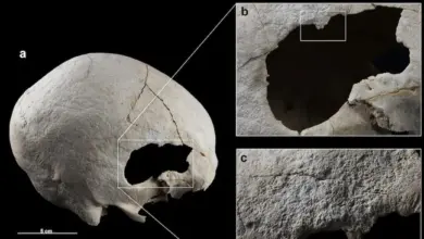 Crânio de 4.500 anos revela duas cirurgias