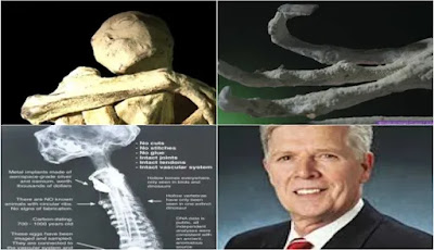 El expresidente de la Academia Estadounidense de Ciencias Forenses dice que las momias de Nazca son reales